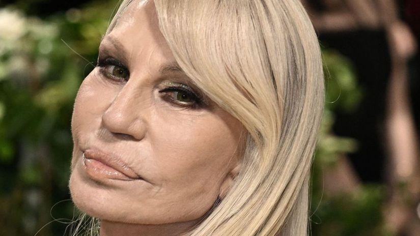 Donatella Versace omladla o 20 rokov Je to ona