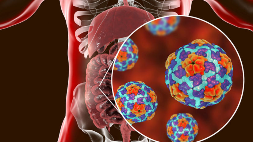 Zltacka typu A ohrozuje cele Slovensko