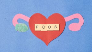 Vedci priznali obrovsky omyl Chorobu milionov zien cele desatrocia zle pomenovali Preco ma byvaly syndrom PCOS nove meno