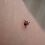 Nebezpecny moze byt aj bezny obed Uhryznutie kliestom moze vyvolat smrtelnu alergiu na maso