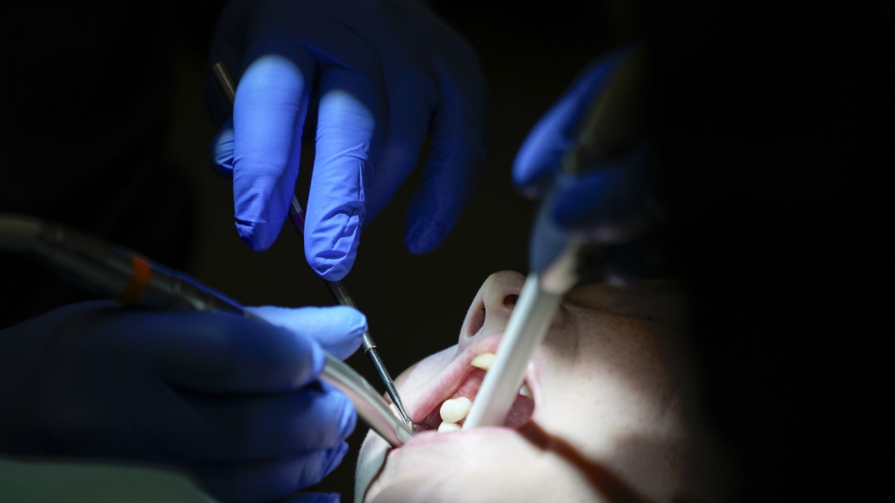 Ziadne korunky ani implantaty Vedci chcu donutit telo aby si nove zuby vypestovalo samo